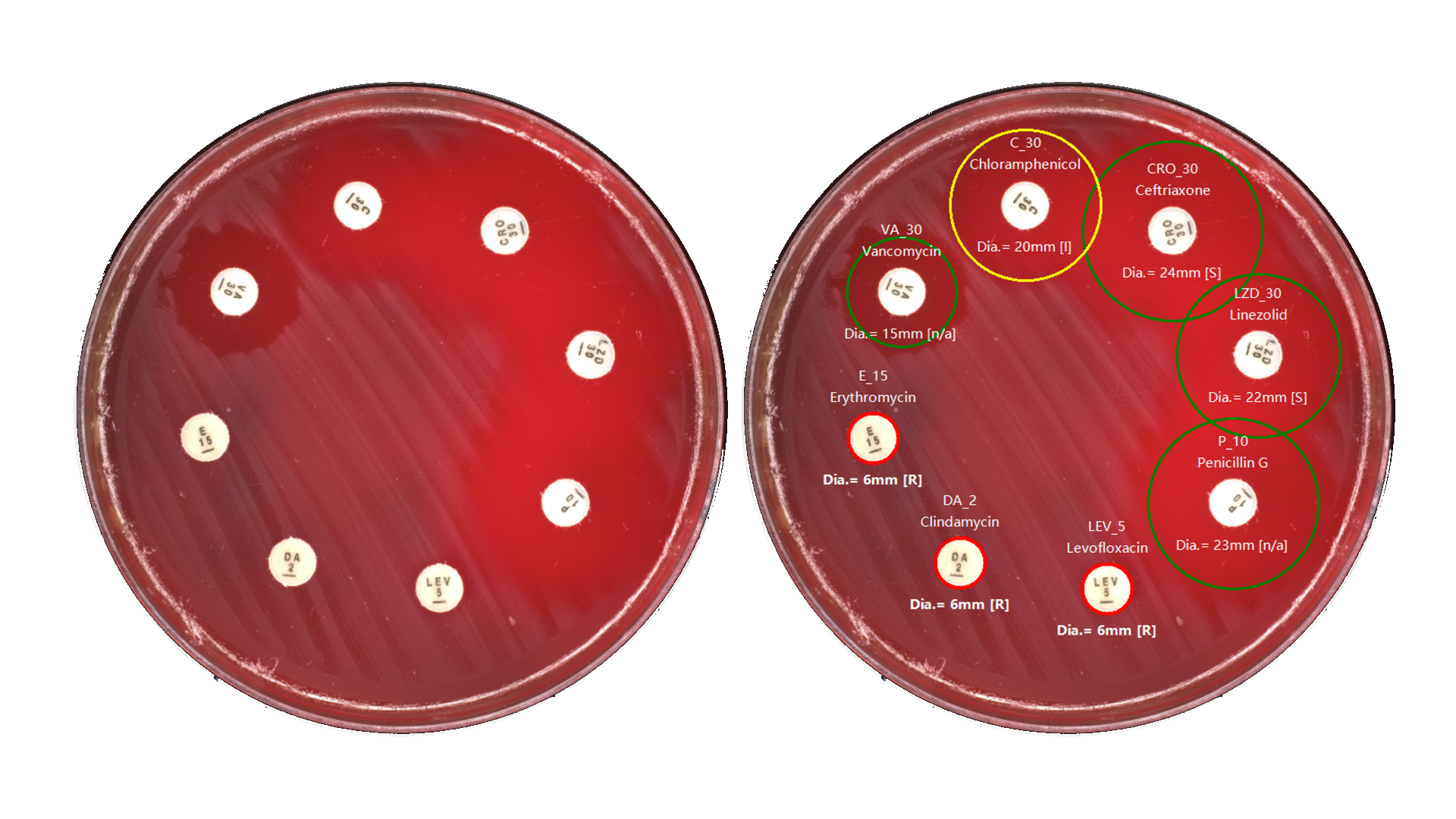 Antimicrobial susceptibility plate with automated zone analysis